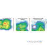 Cuña posicionadora 30º Systam | Ortopedia365.com